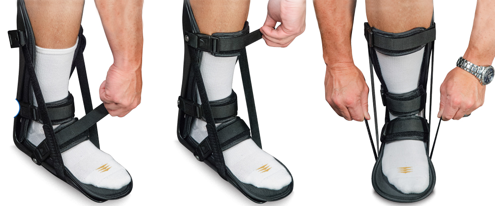 Gebruik een nachtspalk bij een ontstoken peesplaat